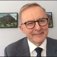 Anthony Albanese